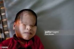 Children-Exposed-to-Spraying-with